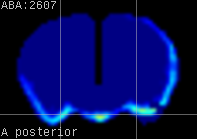 ABA expression energy