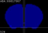 ABA expression energy