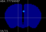 ABA expression energy