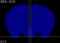 ABA expression energy