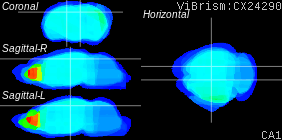 ViBrism