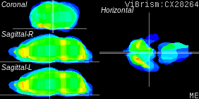 ViBrism
