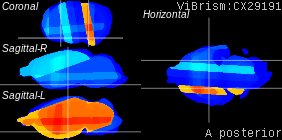 ViBrism