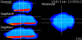 ViBrism