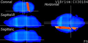 ViBrism