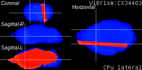 ViBrism