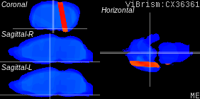 ViBrism